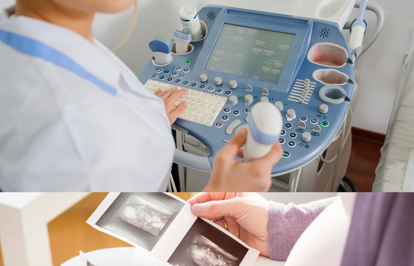 Importance of USG in Women with Dense Breast Tissue